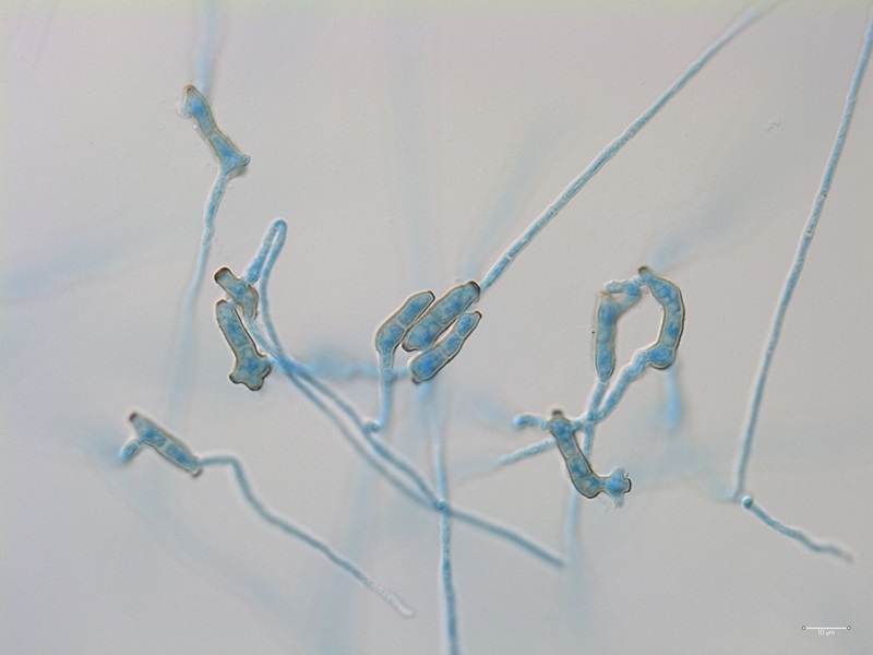 Close up under microscope of blue thread-like spores of the fungus Venturia paralias