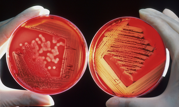 A pair of hands holding two red petri dishes with drug resistant samples
