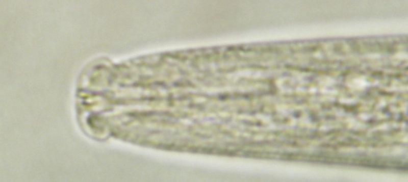 Microscopic detail