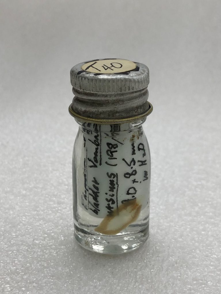 A small jar containing a sheep liver fluke.