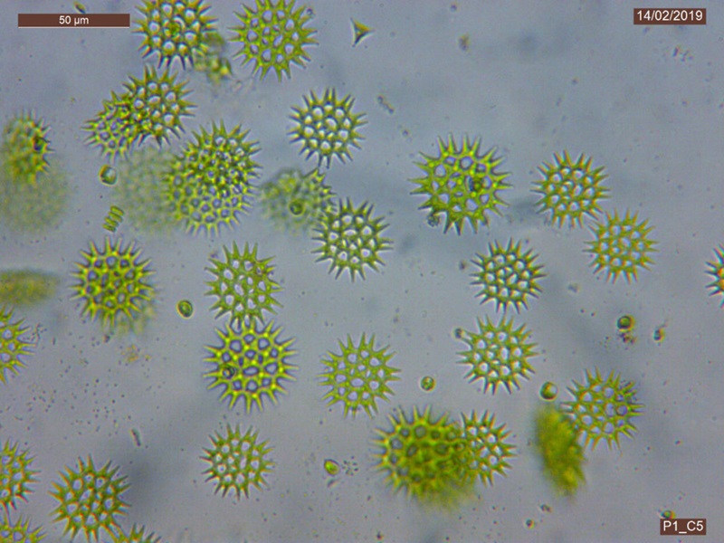 Green, snowflake-like algae cells viewed under a microscope.