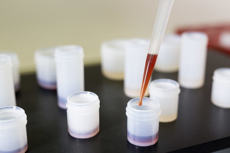 pipett with red wine being injected into small plastic containers