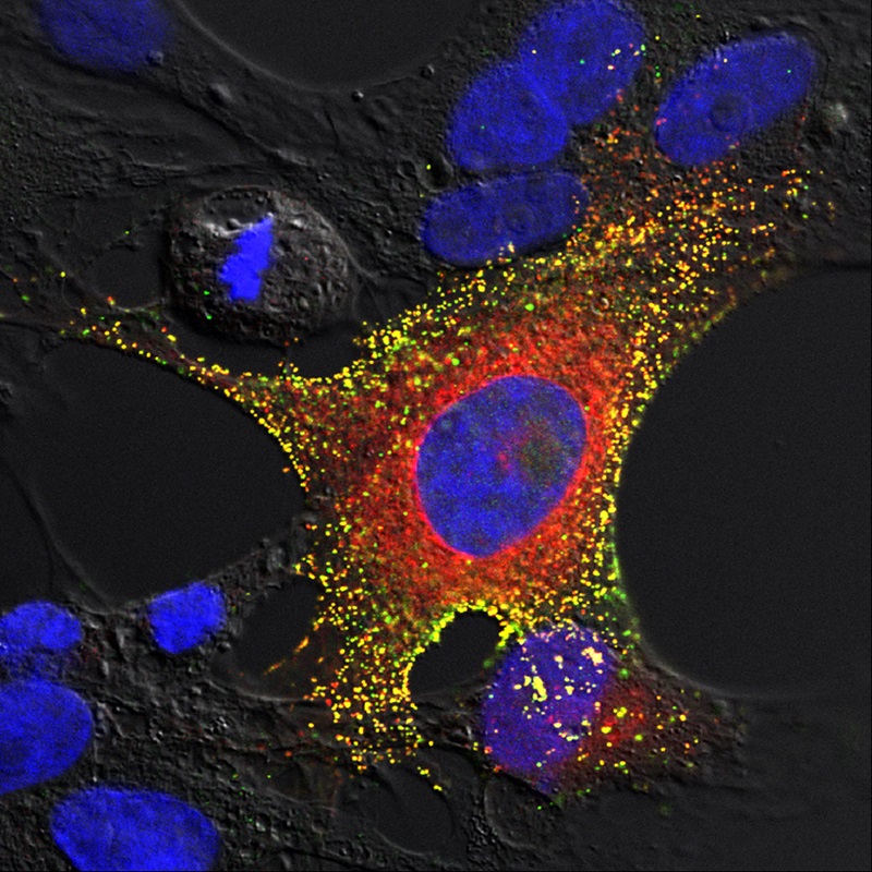 close up of a cell coloured with blue red and yellow