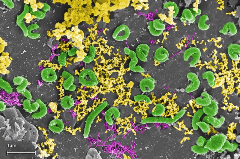 Electron microscope image of microbes (artificially coloured green) and mineral precipitates (yellow). © CSIRO