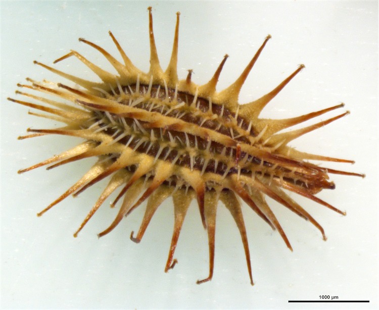 enlared photo of spikey seed