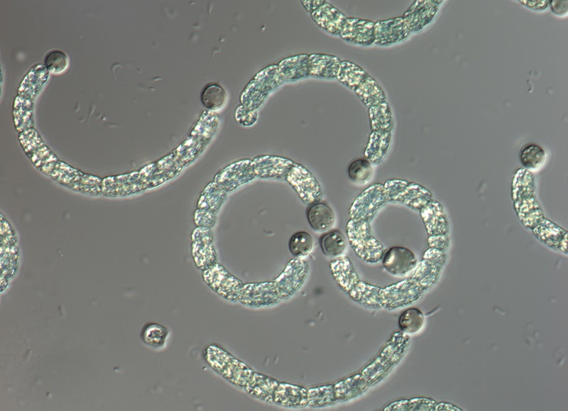 bacteria filaments under the microscope