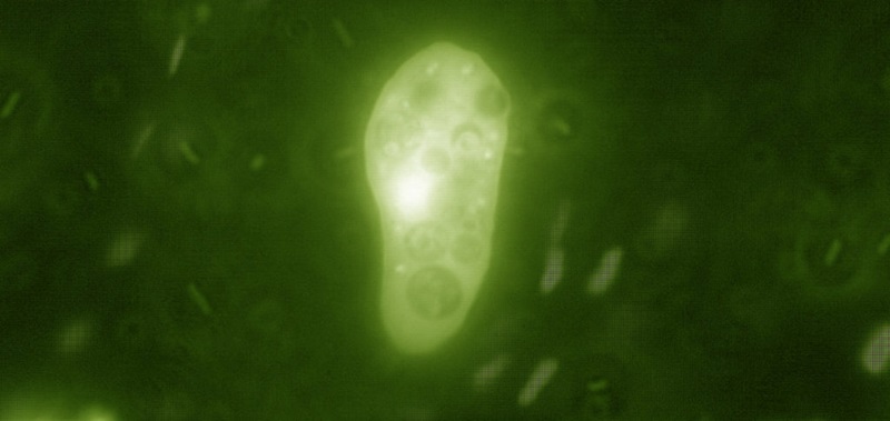 An amoeba cell coloured green