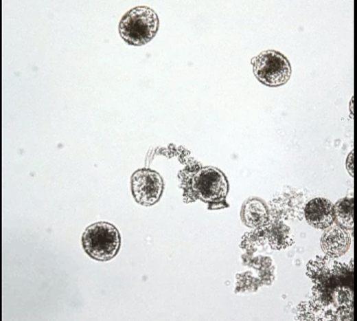 rye grass pollen rupturing under a microscope