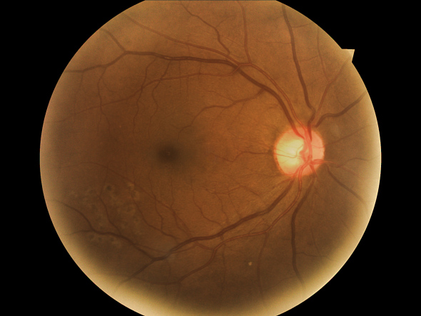 A retina photo of an eye