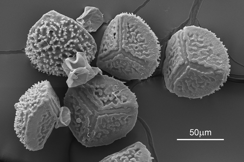 Black and white microscopy image of five hornwort spores showing patters like spines and rivulets.