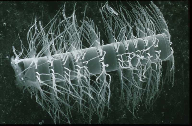 Close-up (Scanning Electron Microscope) image of a marine diatom.