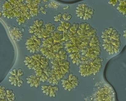 Botryococcus braunii cells view under the microscope. The cells are yellowish green against a grey background and have a flower-like appearance.